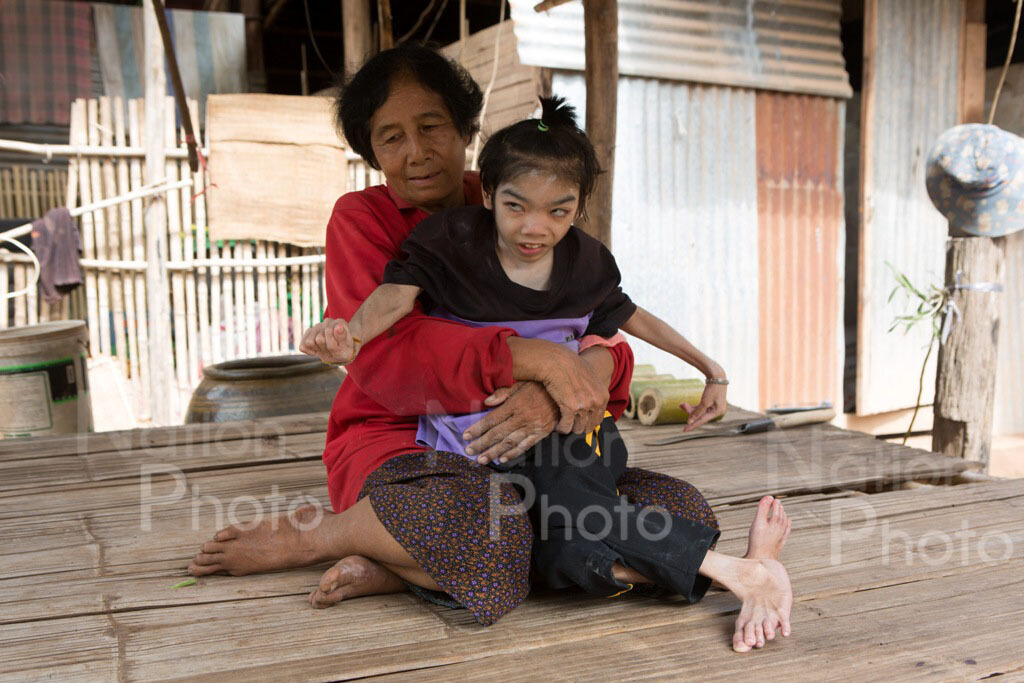 วอนช่วยเหลือ "น้องใบตอง" พิการทางสมองอยู่กับยายเพียงสองคน วอนช่วยเหลือ "น้องใบตอง" พิการทางสมองอยู่กับยายเพียงสองคน