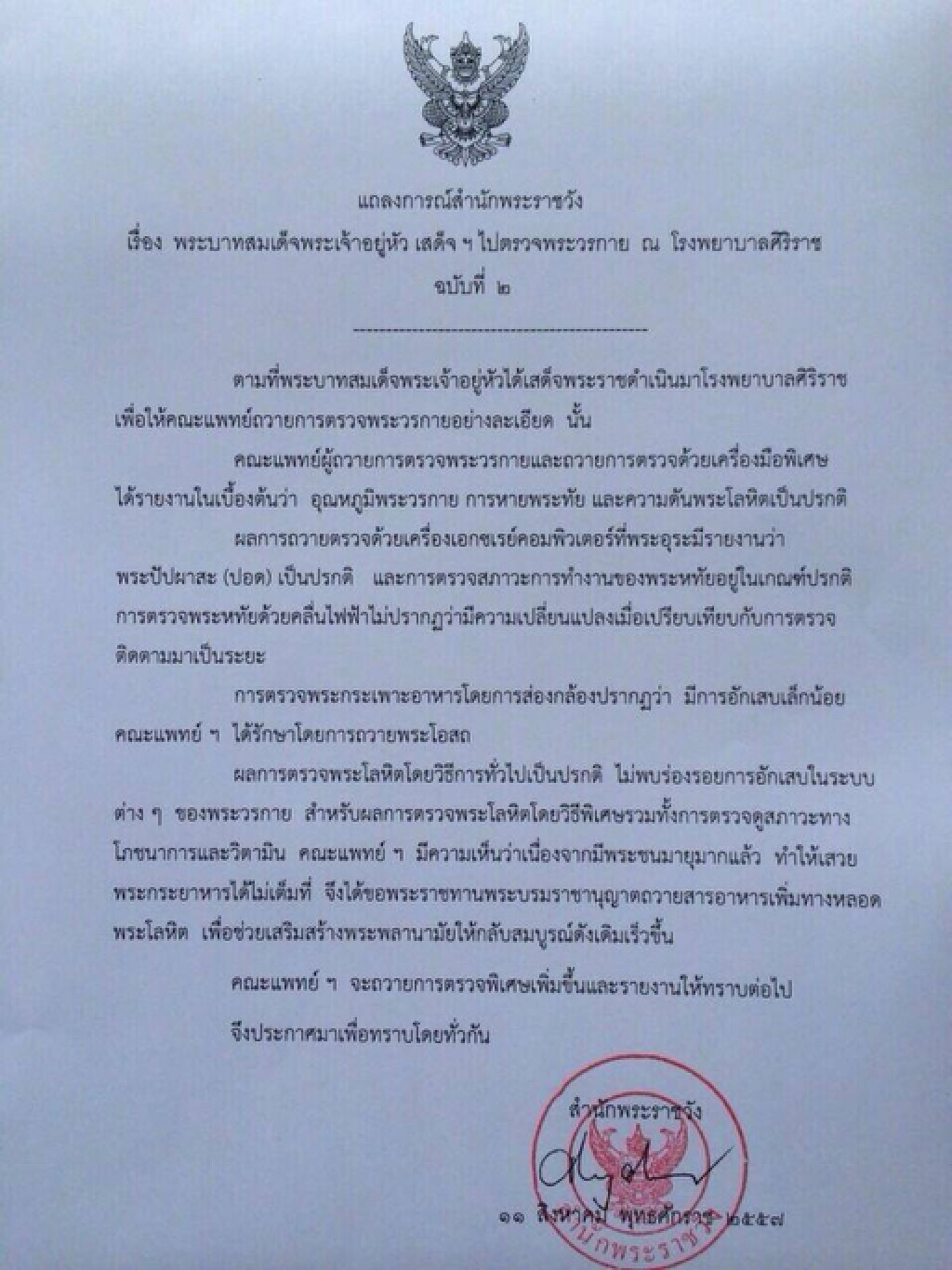 แถลงการณ์ สำนักพระราชวังฉบับที่ 2 ผลตรวจพระวรกายในหลวง แถลงการณ์ สำนักพระราชวังฉบับที่ 2 ผลตรวจพระวรกายในหลวง