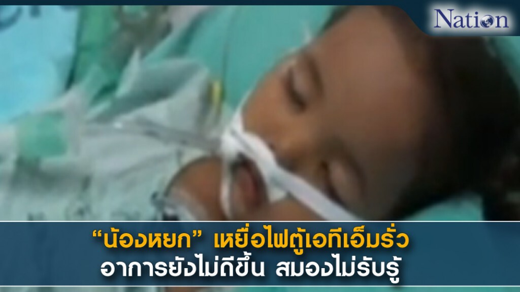 "น้องหยก" เหยื่อไฟตู้เอทีเอ็มรั่ว อาการยังไม่ดีขึ้น สมองไม่รับรู้ "น้องหยก" เหยื่อไฟตู้เอทีเอ็มรั่ว อาการยังไม่ดีขึ้น สมองไม่รับรู้