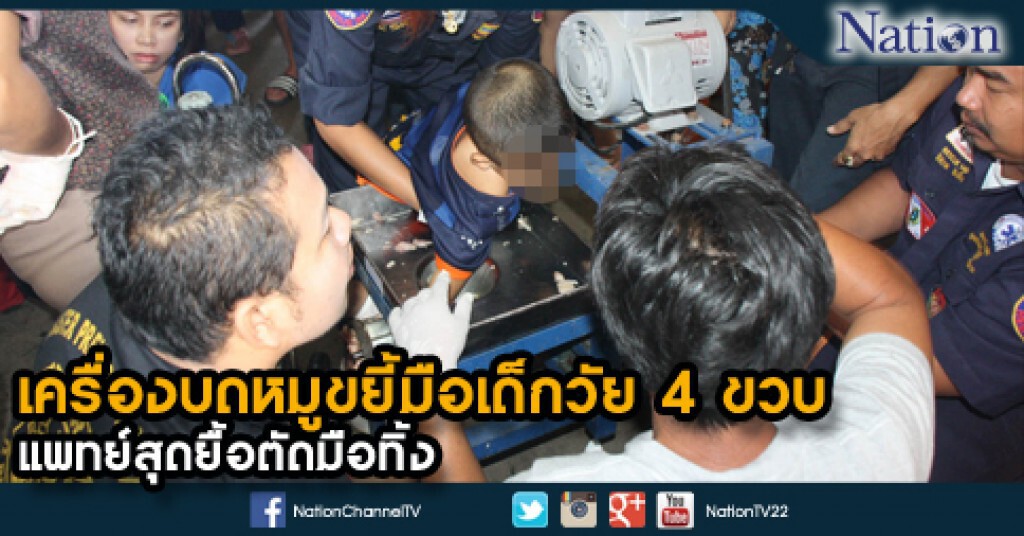 เศร้า...เครื่องบดหมูขยี้มือเด็กวัย 4 ขวบ  แพทย์สุดยื้อตัดมือทิ้ง