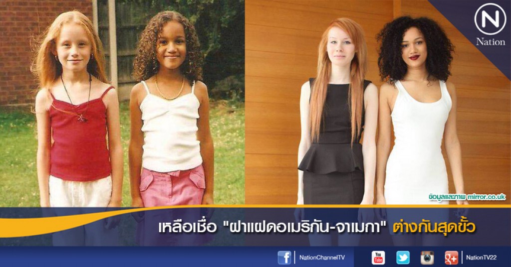 เหลือเชื่อ "ฝาแฝดอเมริกัน-จาเมกา" ต่างกันสุดขั้ว เหลือเชื่อ "ฝาแฝดอเมริกัน-จาเมกา" ต่างกันสุดขั้ว
