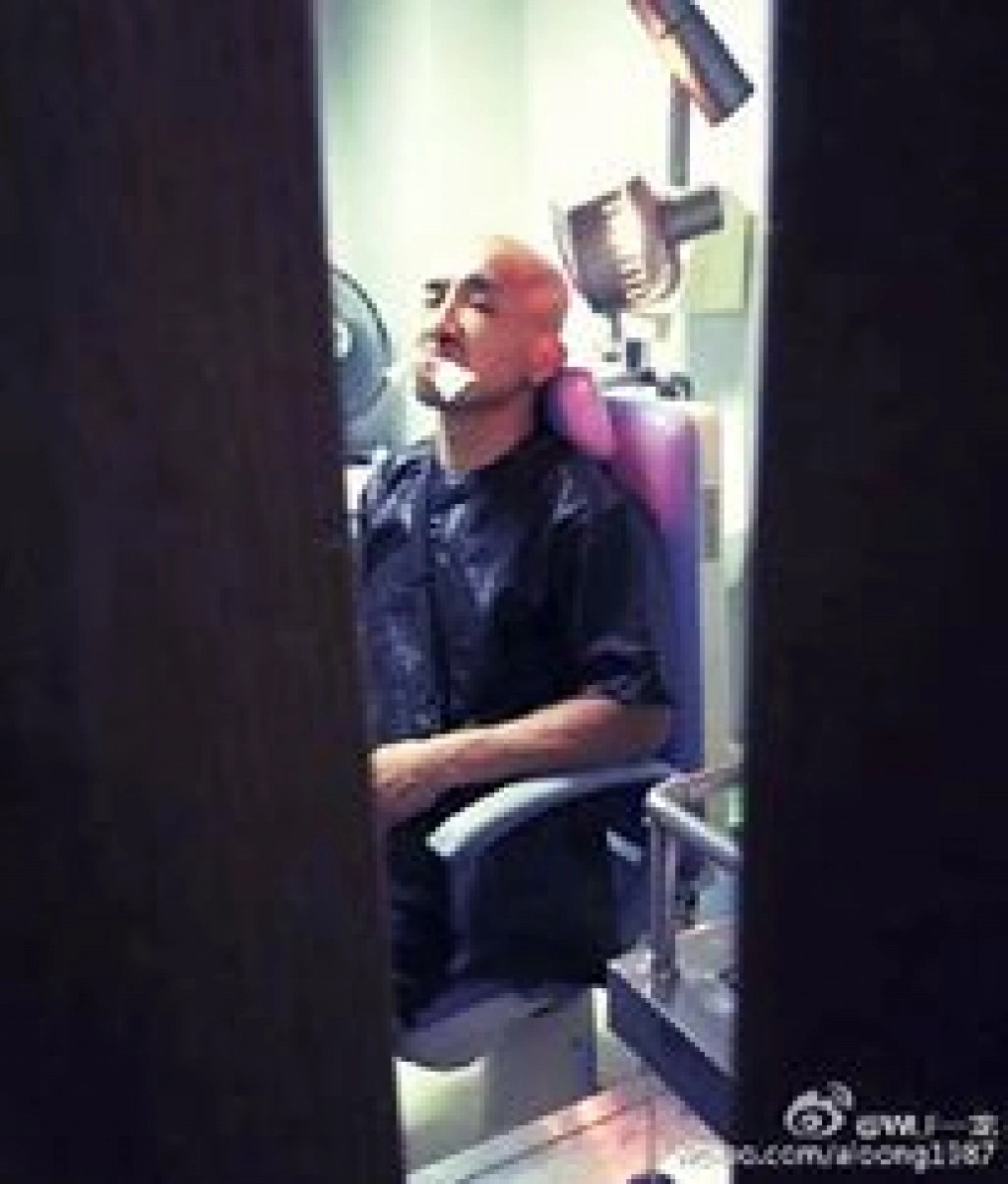 เผยภาพ "อี้ หลง" กังฟูจีนจมูกหักหลังพ่ายบัวขาว