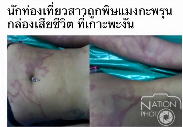 อ.ธรณ์แนะวิธีหลีกเลี่ยง-ปฏิบัติเรื่อง"แมงกะพรุนกล่อง"