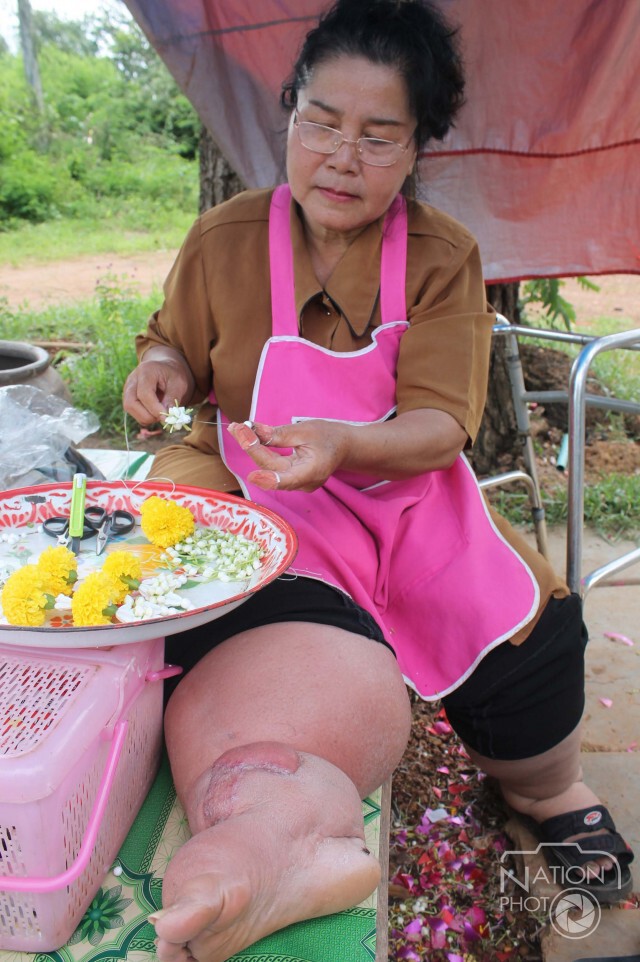หญิงวัย 60ปี"ป่วยเท้าช้าง" ขายพวงมาลัยเลี้ยงพ่อ-หลาน