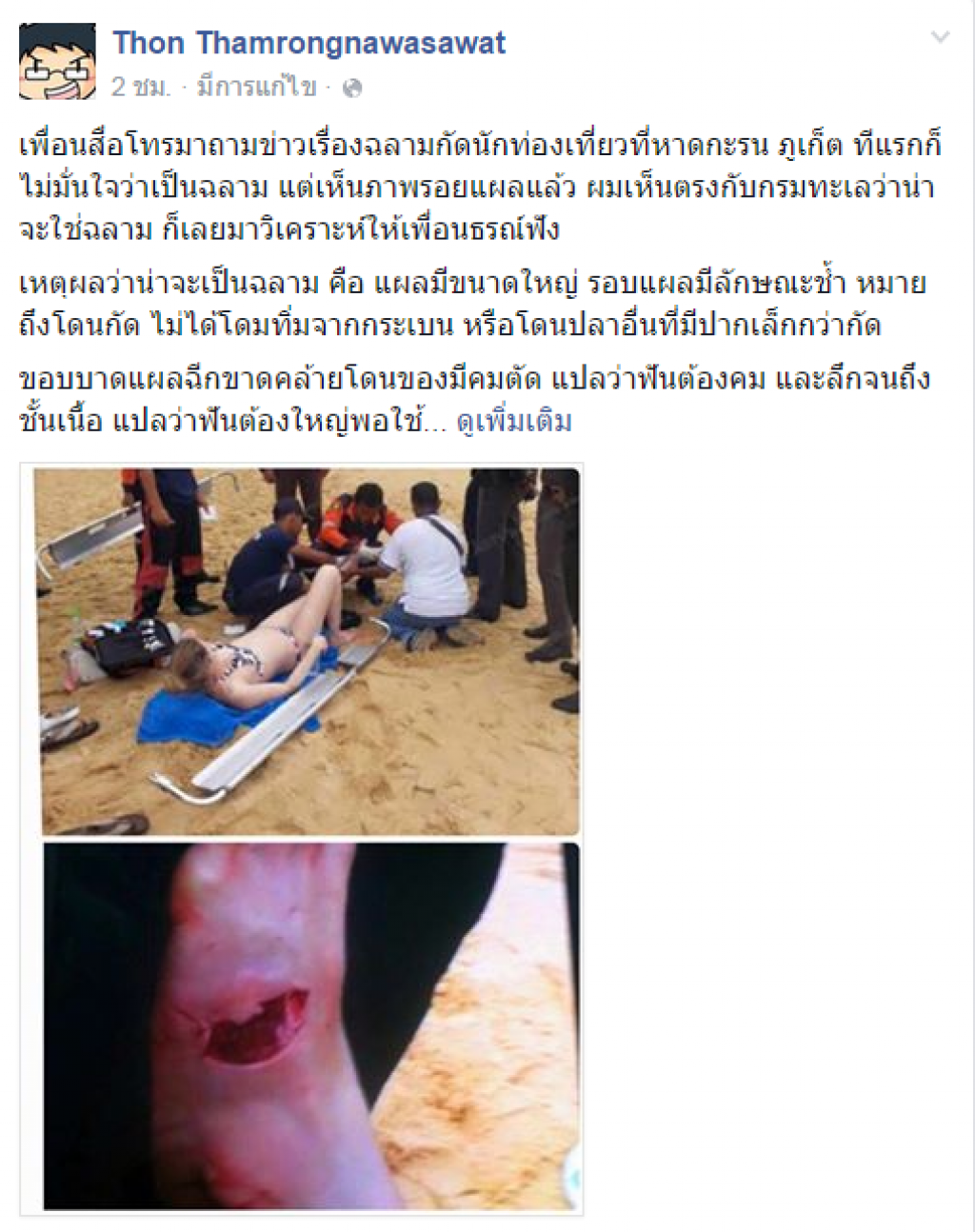 ดร.ธรณ์ชี้"ฉลาม"กัดนทท.ออสซี่ รอผลพิสูจน์จากกรมประมง