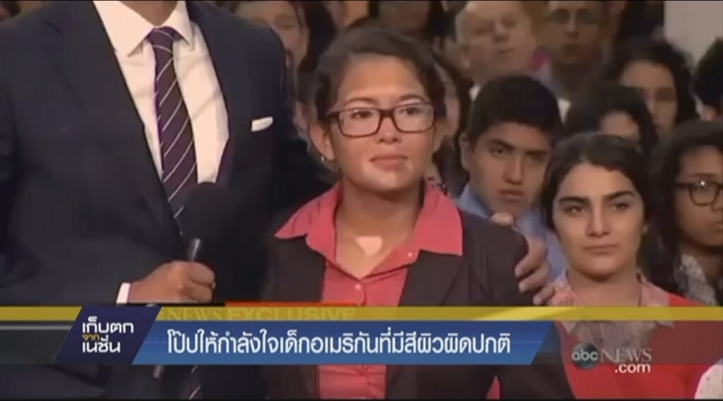 โป๊ปให้กำลังใจเด็กสาวอเมริกันที่มีสีผิวผิดปกติ โป๊ปให้กำลังใจเด็กสาวอเมริกันที่มีสีผิวผิดปกติ
