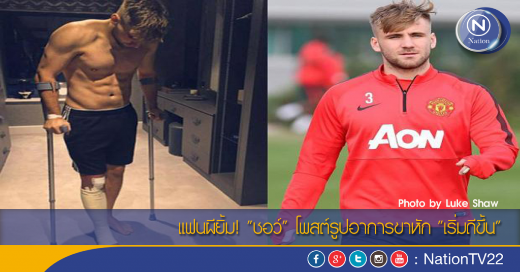 แฟนผียิ้ม! "ชอว์" โพสต์รูปอาการขาหัก "เริ่มดีขึ้น" แฟนผียิ้ม! "ชอว์" โพสต์รูปอาการขาหัก "เริ่มดีขึ้น"