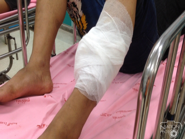 ช้างแคระมูลนิธิเพื่อนช้างลำปาง ใช้งวงฟาดควาญช้างหวิดดับ