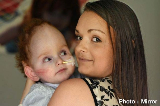 ปาฎิหาริย์! เมื่อทารกไม่มีสมอง เรียก"แม่"ได้ ครั้งแรก