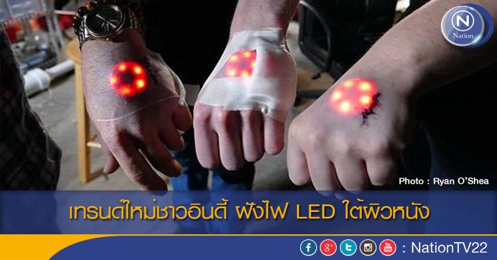 เทรนด์ใหม่ชาวอินดี้ ฝังไฟ LED ใต้ผิวหนัง เทรนด์ใหม่ชาวอินดี้ ฝังไฟ LED ใต้ผิวหนัง