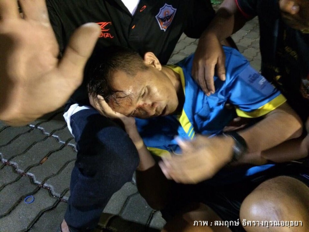 แฟนบอลสตูลเดือด ไล่ทำร้าย"เชิ้ตดำ" ไม่พอใจตัดสินค้านสายตา แฟนบอลสตูลเดือด ไล่ทำร้าย"เชิ้ตดำ" ไม่พอใจตัดสินค้านสายตา