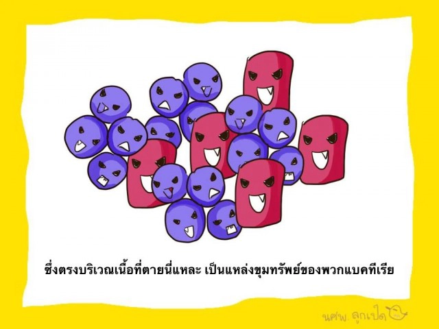 ไขข้อสงสัยการตัดข้อเท้า "ปอ"