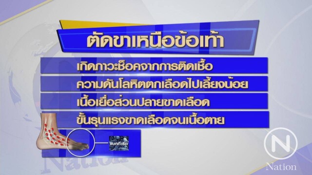หมอชี้ "ปอถูกตัดข้อเท้าซ้าย" เป็นผลข้างเคียงจากอาการป่วย