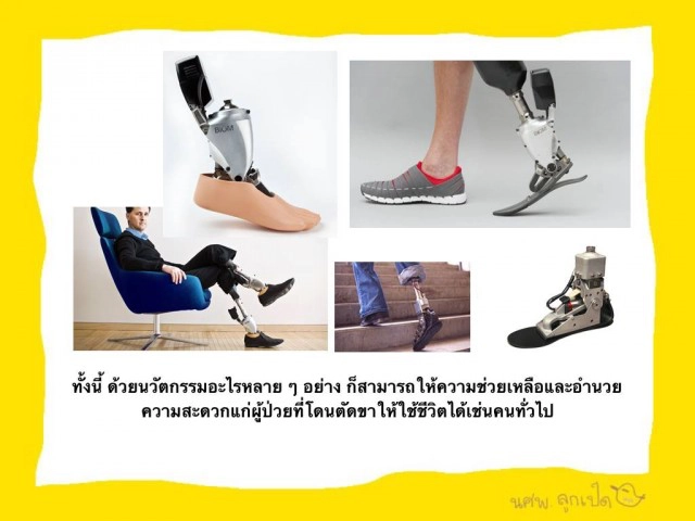 ไขข้อสงสัยการตัดข้อเท้า "ปอ"