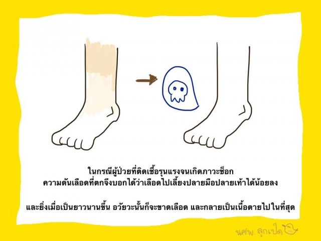 ไขข้อสงสัยการตัดข้อเท้า "ปอ"