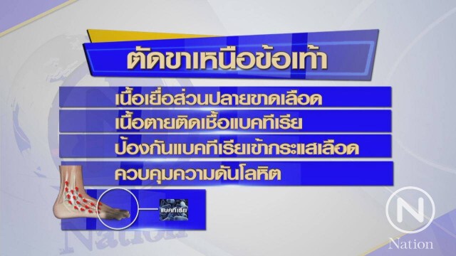 หมอชี้ "ปอถูกตัดข้อเท้าซ้าย" เป็นผลข้างเคียงจากอาการป่วย