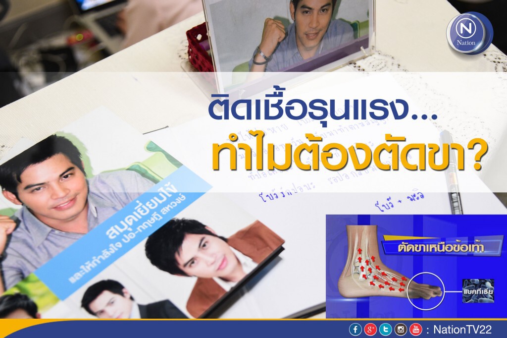 ติดเชื้อรุนแรง...ทำไมต้องตัดขา?