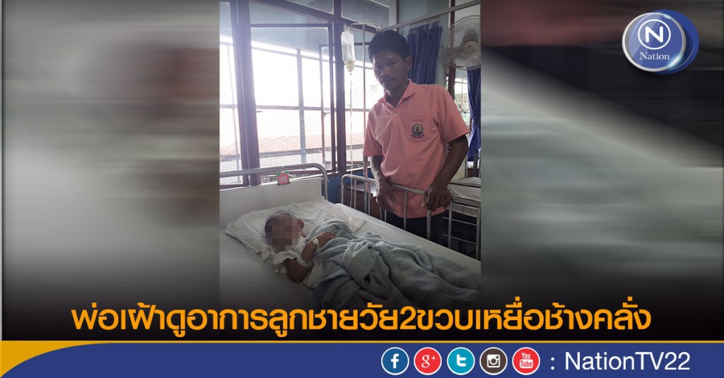 พ่อเฝ้าดูอาการลูกชายวัย2ขวบเหยื่อช้างคลั่ง พ่อเฝ้าดูอาการลูกชายวัย2ขวบเหยื่อช้างคลั่ง