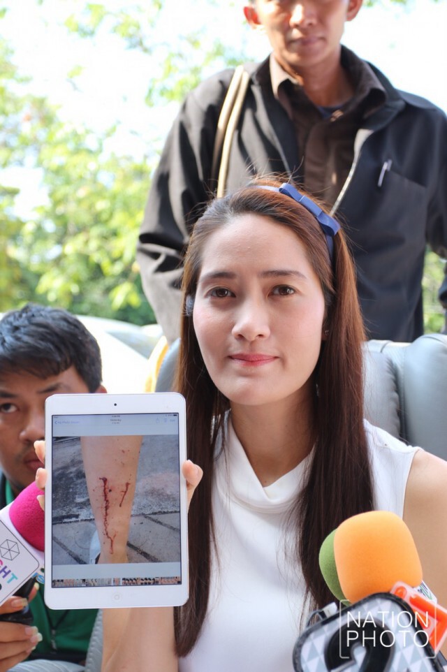 ฟัง รปภ.พยานในเหตุการณ์ เล่าชัดๆ ปมดราม่า "นุ่น-เพื่อนบ้าน"