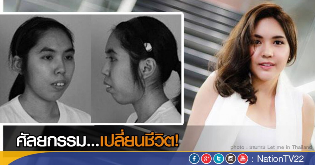ศัลยกรรม...เปลี่ยนชีวิต!