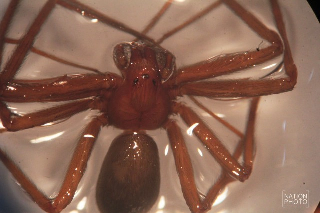 วิธีปฐมพยาบาลเบื้องต้น หากถูก"แมงมุมสันโดษ"กัด!