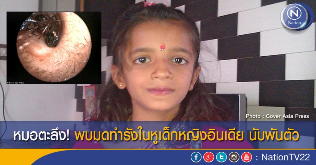 หมอตะลึง! พบมดทำรังในหูเด็กหญิงอินเดีย นับพันตัว