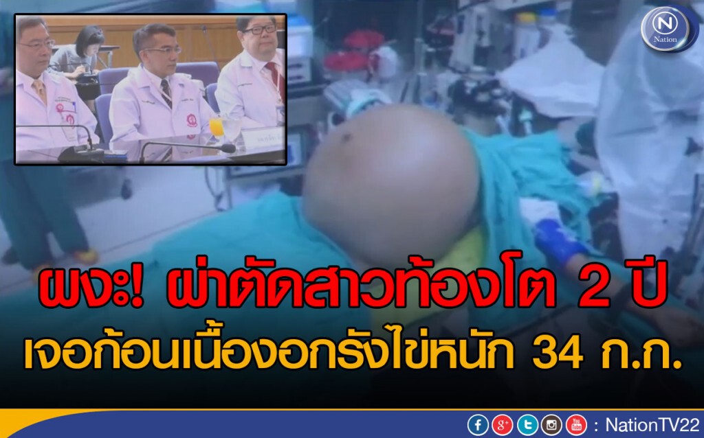 ผงะ! ผ่าตัดสาวท้องโต 2 ปี เจอก้อนเนื้องอกรังไข่หนัก 34 กก. ผงะ! ผ่าตัดสาวท้องโต 2 ปี เจอก้อนเนื้องอกรังไข่หนัก 34 กก.