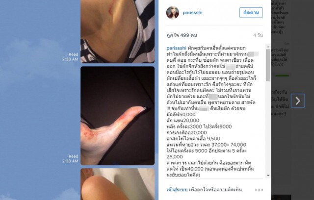 สาวแฉอ้างโดนนักแสดงซีรีส์ดัง  ซ้อมปางตาย