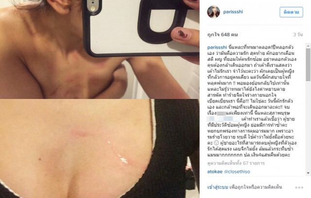 สาวแฉอ้างโดนนักแสดงซีรีส์ดัง  ซ้อมปางตาย