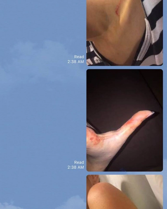 "หยก เลิฟซิค" ปัดซ้อมสาว "ผักกาด" แฉยับให้เงินเลี้ยงดู แต่โดนหักหลัง