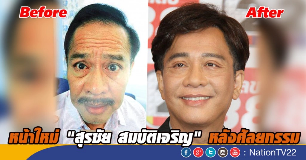 "สุรชัย สมบัติเจริญ" เปิดหน้าใหม่ หลัง "ศัลยกรรม"