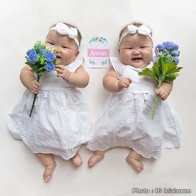 "เลอาร์-ลอว์เรน"แฝดตัวจิ๋วที่มีผู้ติดตามไอจีกว่าแสนคน