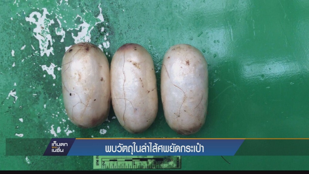 พบวัตถุในลำไส้ ศพยัดกระเป๋า พบวัตถุในลำไส้ ศพยัดกระเป๋า