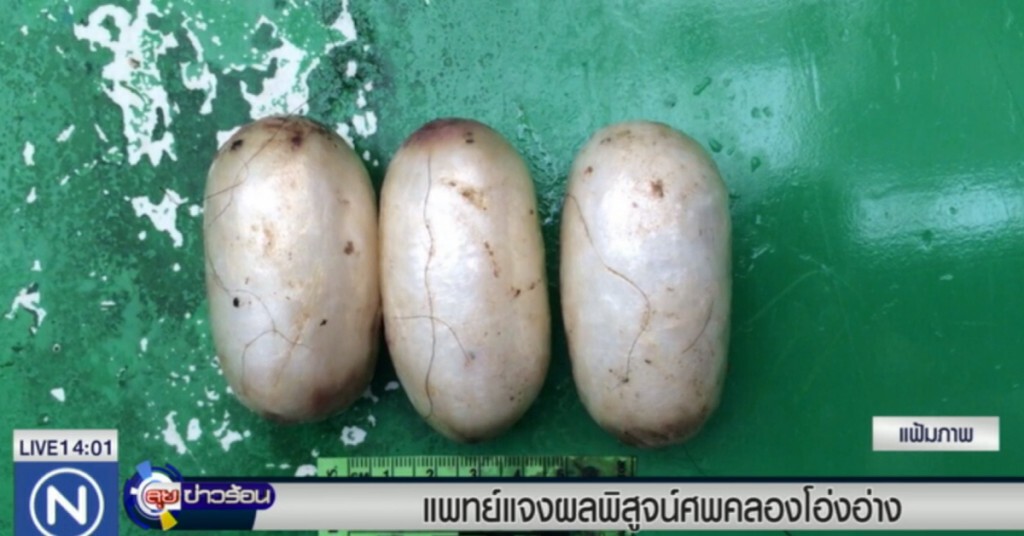 แพทย์แจงผลพิสูจน์ศพคลองโอ่งอ่าง แพทย์แจงผลพิสูจน์ศพคลองโอ่งอ่าง
