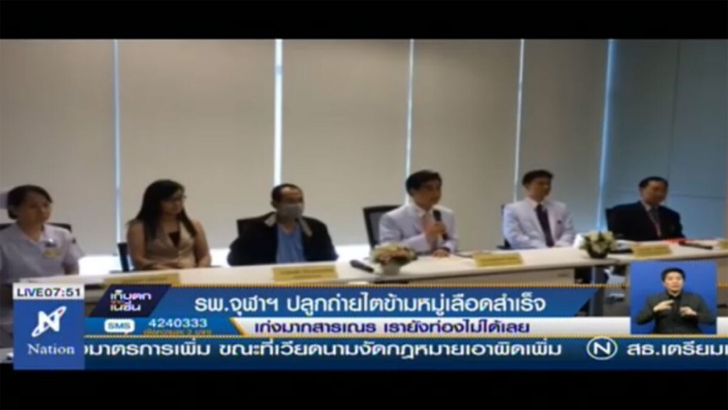 รพ.จุฬาฯ ปลูกถ่ายไตข้ามหมู่เลือดสำเร็จ