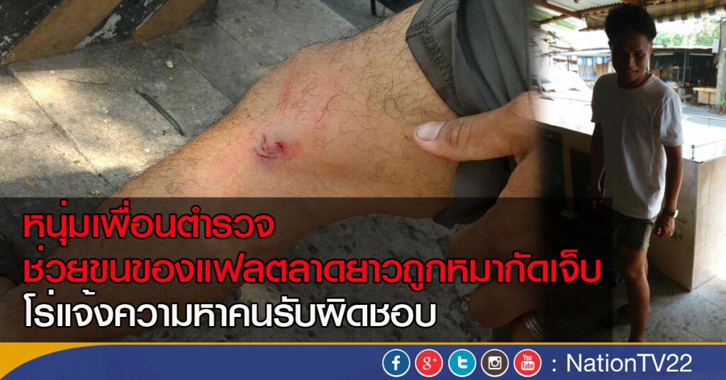 หนุ่มเพื่อนตำรวจช่วยขนของแฟลตลาดยาวถูกหมากัดเจ็บ 
โร่แจ้งความหาคนรับผิดชอบ