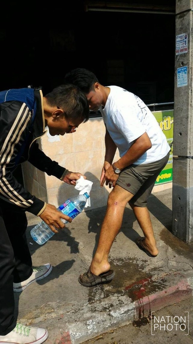 หนุ่มเพื่อนตำรวจช่วยขนของแฟลตลาดยาวถูกหมากัดเจ็บ 
โร่แจ้งความหาคนรับผิดชอบ