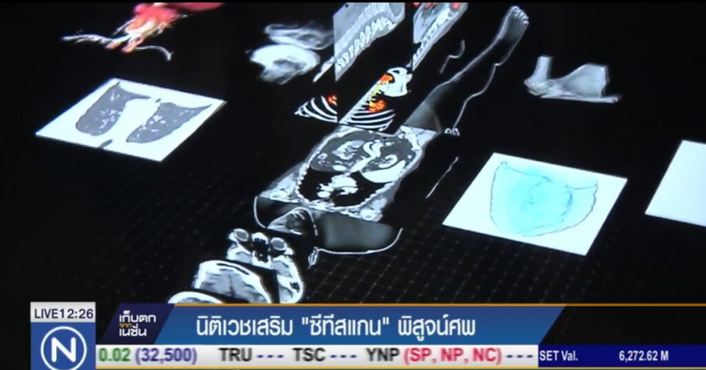 นิติเวชนำเครื่อง CT-Scan พิสูจน์ศพที่ตายผิดธรรมชาติ