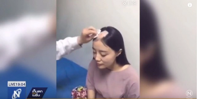 สาวจีน เลียนแบบคลิป "ข้าวโพดสว่าน" พลาด ผมหลุดเป็นกำ