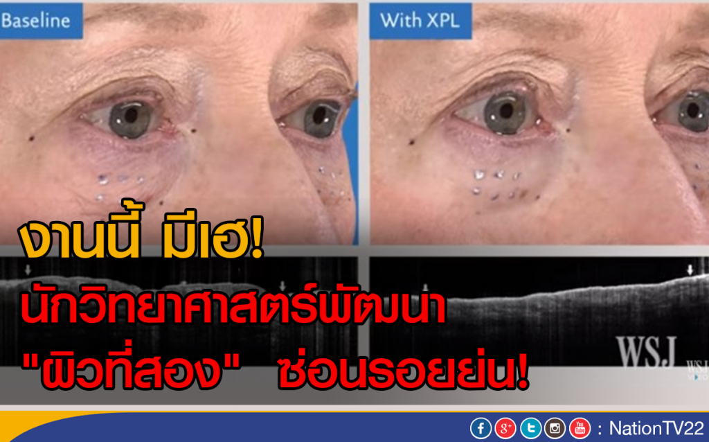 นักวิทยาศาสตร์พัฒนา "ผิวที่สอง" ซ่อนรอยย่น! นักวิทยาศาสตร์พัฒนา "ผิวที่สอง" ซ่อนรอยย่น!