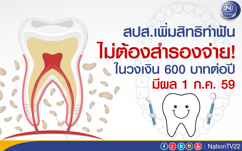 สปส.เพิ่มสิทธิทำฟัน ไม่ต้องสำรองจ่าย! ในวงเงิน 600 บาทต่อปี มีผล 1 ก.ค.นี้