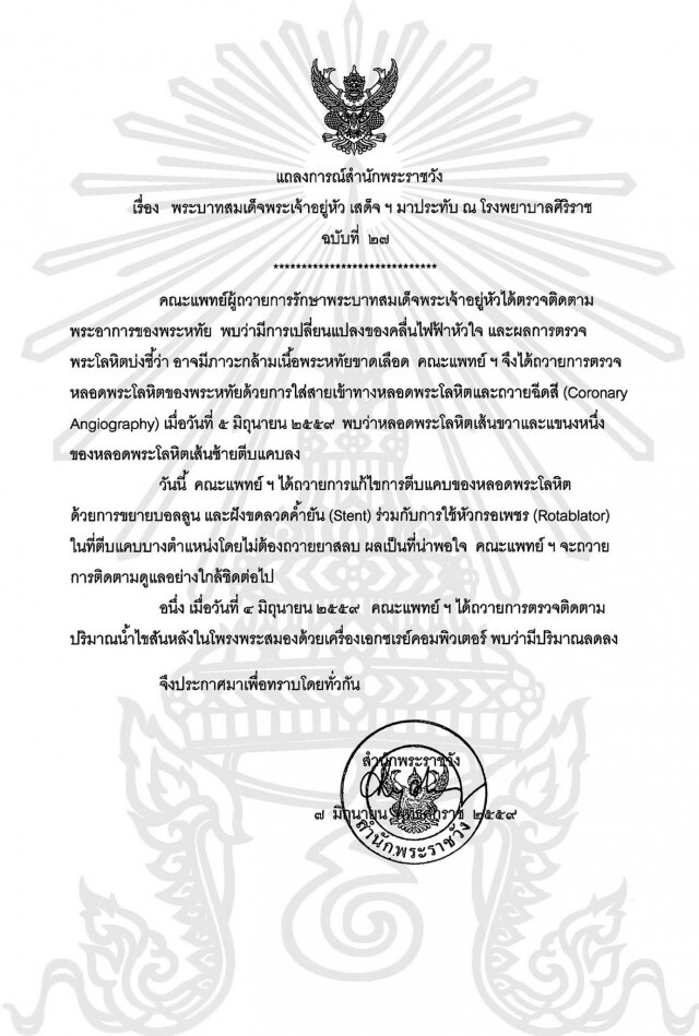 แถลงการณ์ ฉ. 27  แพทย์ถวายการแก้ไขหลอดพระโลหิตตีบแคบของในหลวง ผลเป็นที่น่าพอใจ