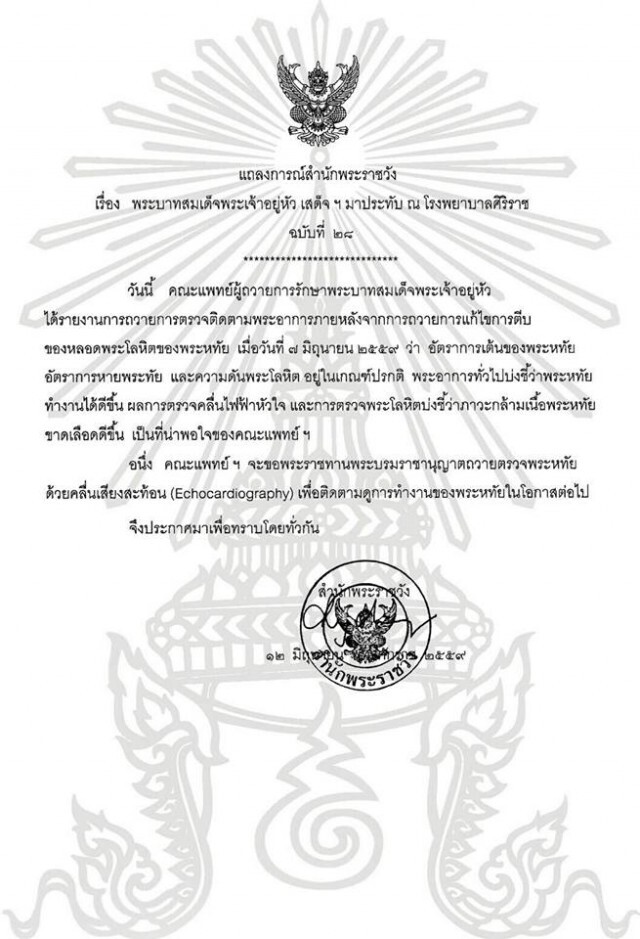 แถลงการณ์ ฉ.28  "ในหลวง" พระอาการดีขึ้น การทำงานของพระหทัยดีขึ้น เป็นที่พอใจของคณะแพทย์