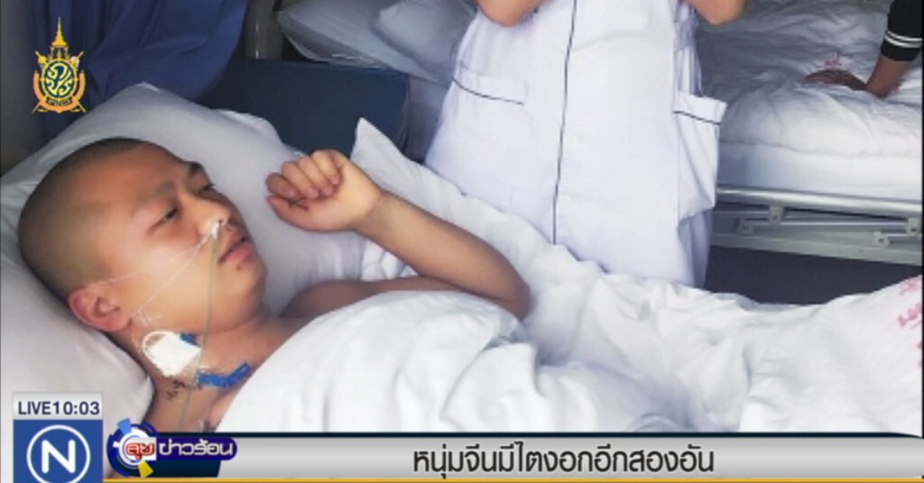 พบหนุ่มจีนมีไตงอกอีก 2 อัน พบหนุ่มจีนมีไตงอกอีก 2 อัน
