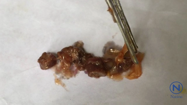 พบซากคล้าย"กิ้งกือ"ในปลากระป๋อง
เร่งส่ง สสจ.ตรวจสอบ