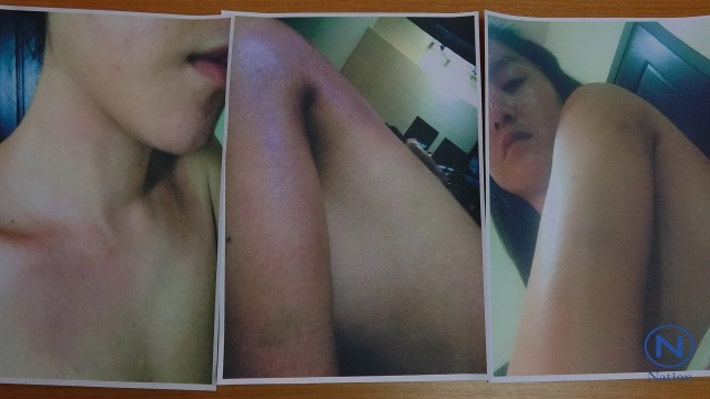 ดาราสาว พบตร.จี้เร่งคดี อดีตแฟนหนุ่มนักบินทำร้าย
หวั่นชีวิตไม่ปลอดภัย