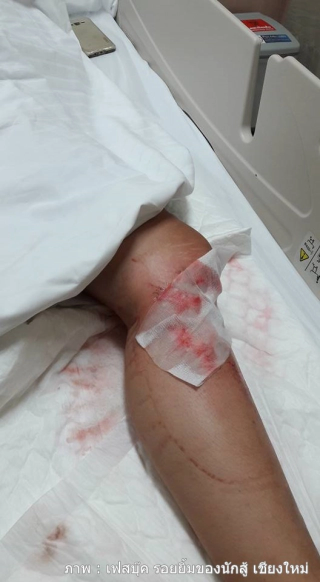 พ่อโพสต์เฟสบุ๊ก ระบาย!
ลูกสาวขับรถเก็บโปเกมอน โก จนเกิดอุบัติเหตุ