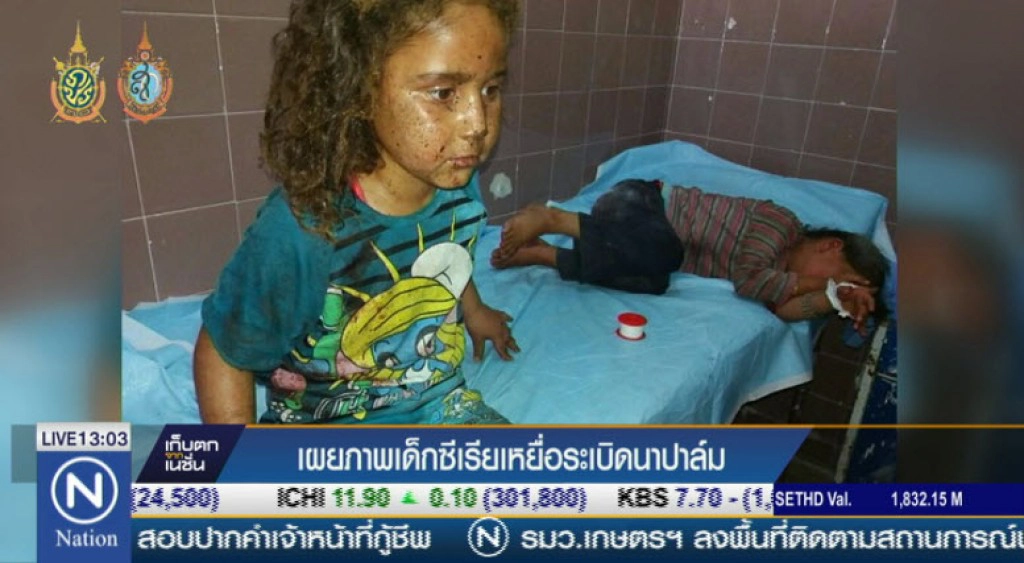 ภาพเด็กซีเรียเหยื่อระเบิดนาปาล์ม ภาพเด็กซีเรียเหยื่อระเบิดนาปาล์ม