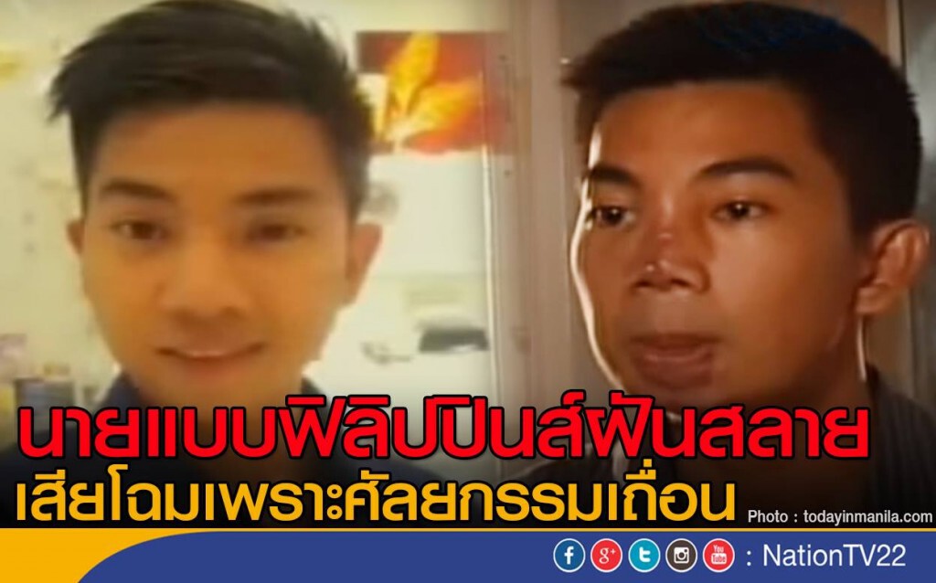 นายแบบฟิลิปปินส์ฝันสลาย
เสียโฉมเพราะศัลยกรรมเถื่อน นายแบบฟิลิปปินส์ฝันสลาย
เสียโฉมเพราะศัลยกรรมเถื่อน
