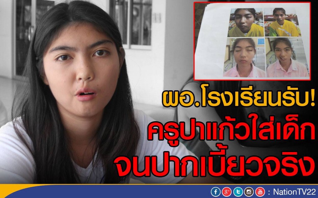 ผอ.โรงเรียนรับ! ครูปาแก้วใส่เด็ก จนปากเบี้ยวจริง